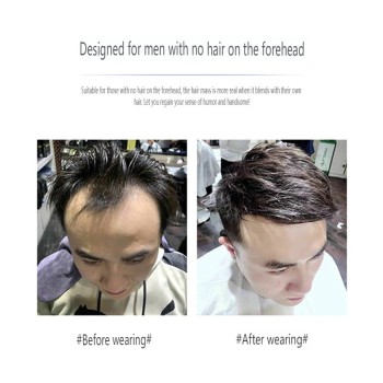 发际线假发男士假发贴前额补发片真发全手织生物头皮刘海