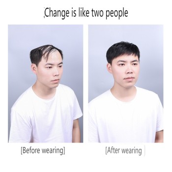 男士补发片假发套头顶补发前额秃顶补发垫接发翻盖假发真发男发块